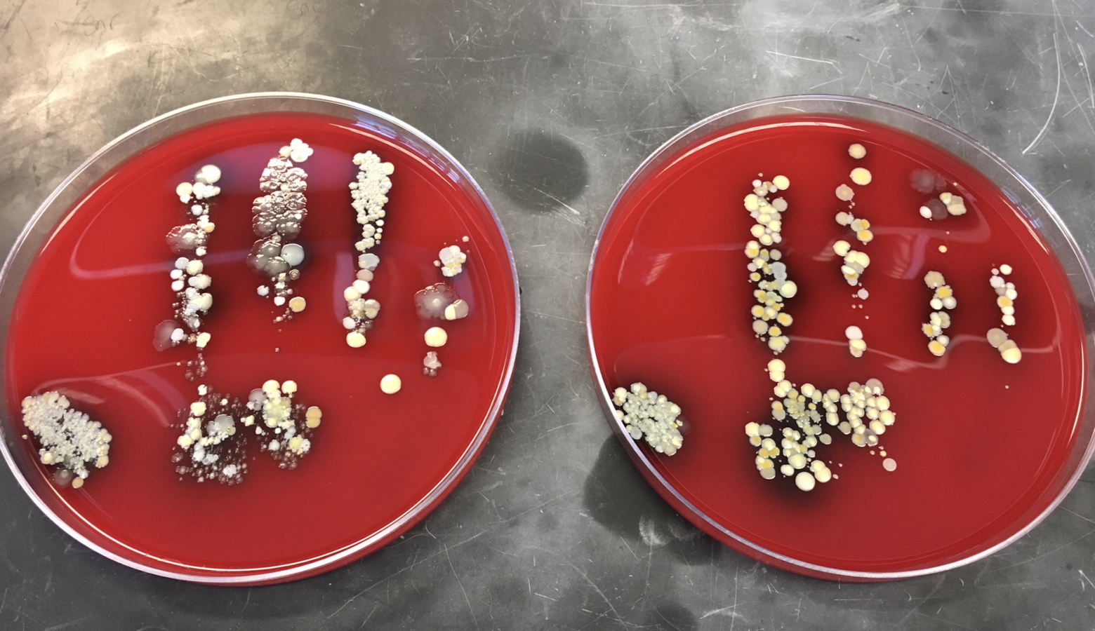 Reporter Jill Sheridan participated in the experiment. The petri dish on the left is her before, and the dish on the right is her after. (Photo courtesy IU Health pathology lab)