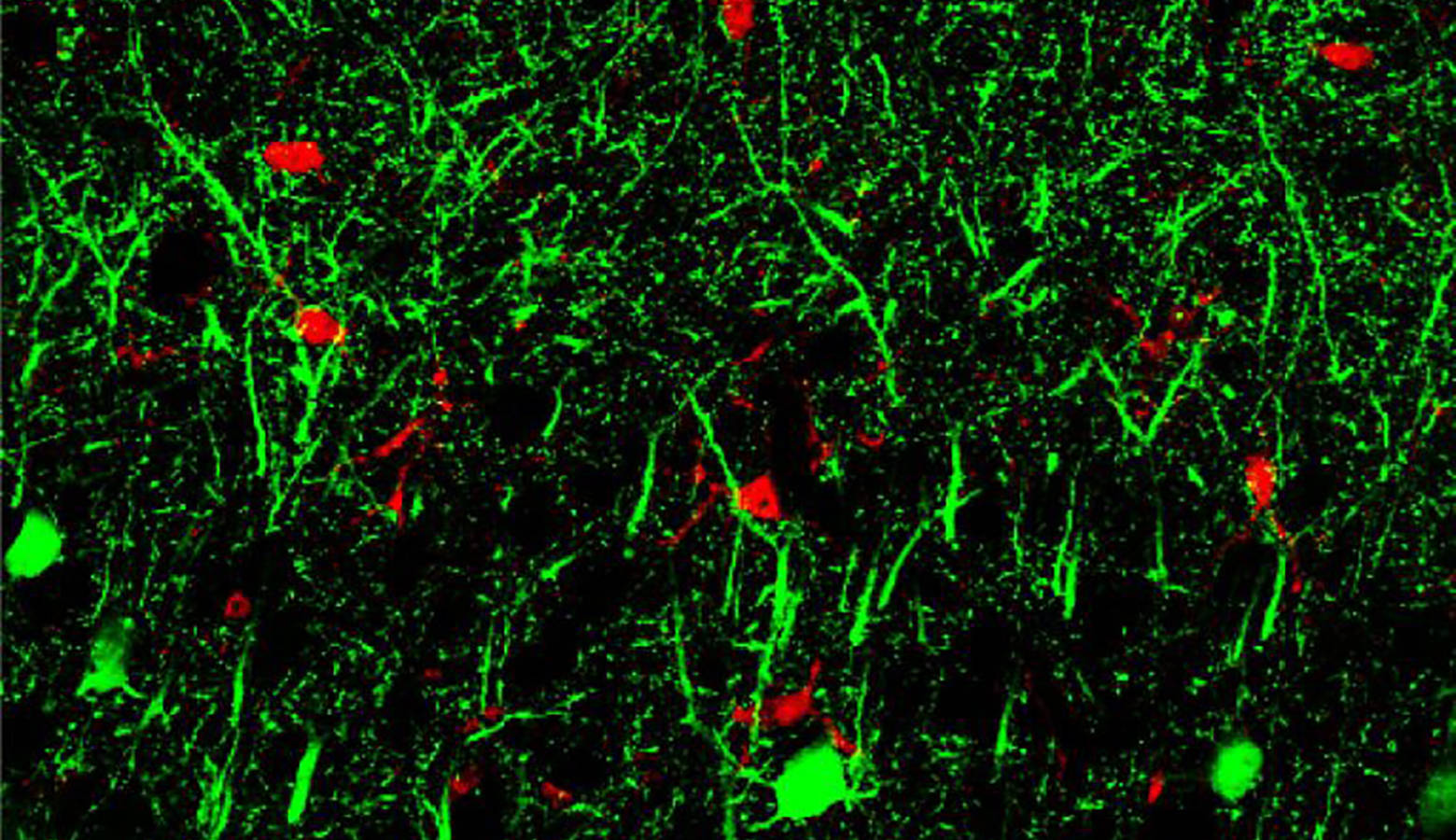 MicroRNA 142, in green, shown in neurons in the brain. The molecule may represent a potential biomarker to diagnose or predict dementia. (Photo courtesy of Hui-Chen Lu/Indiana University)